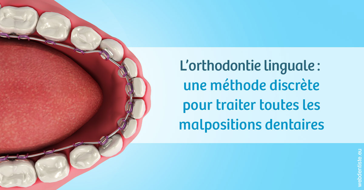 https://dr-roquette-guillaume.chirurgiens-dentistes.fr/L'orthodontie linguale 1