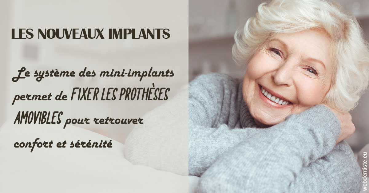 https://dr-roquette-guillaume.chirurgiens-dentistes.fr/Les nouveaux implants 1