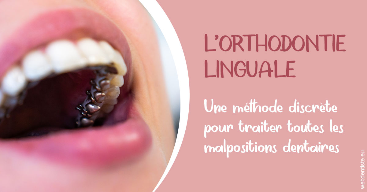 https://dr-roquette-guillaume.chirurgiens-dentistes.fr/L'orthodontie linguale 2
