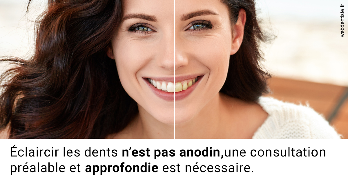 https://dr-roquette-guillaume.chirurgiens-dentistes.fr/Le blanchiment 2