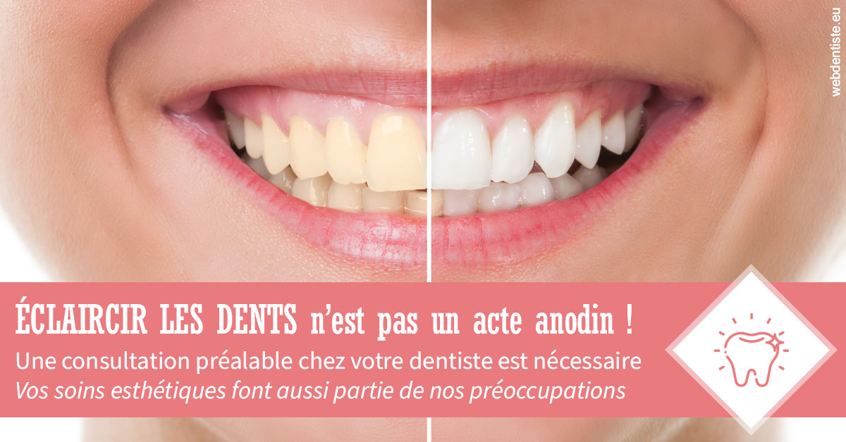https://dr-roquette-guillaume.chirurgiens-dentistes.fr/Eclaircir les dents 1