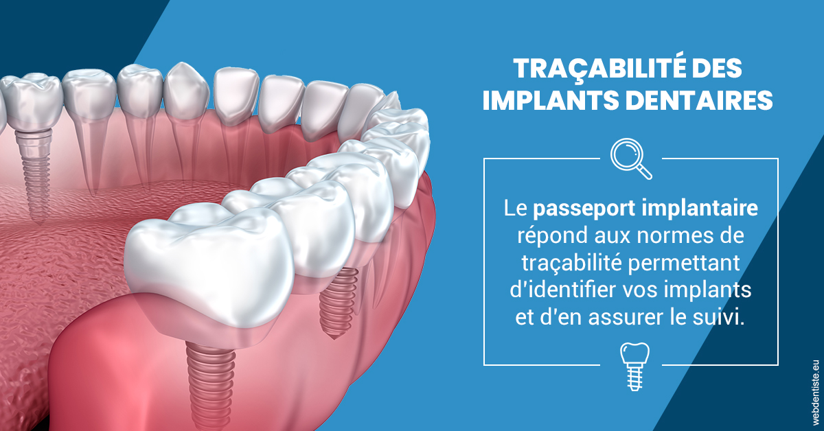 https://dr-roquette-guillaume.chirurgiens-dentistes.fr/T2 2023 - Traçabilité des implants 1