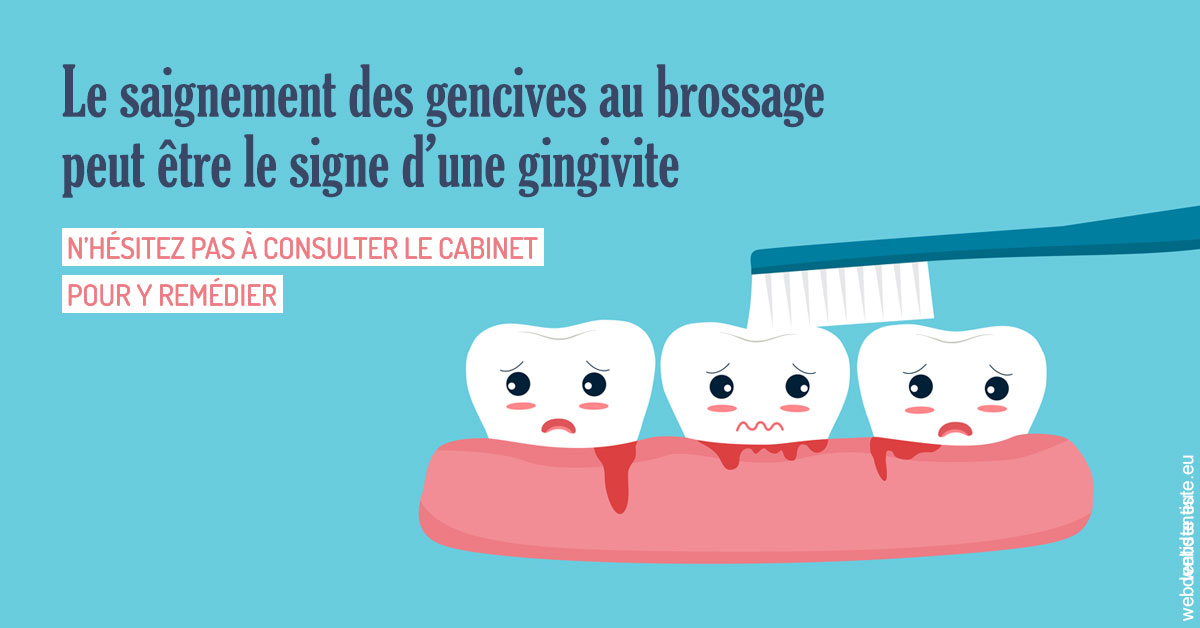 https://dr-roquette-guillaume.chirurgiens-dentistes.fr/Saignement gencives 2
