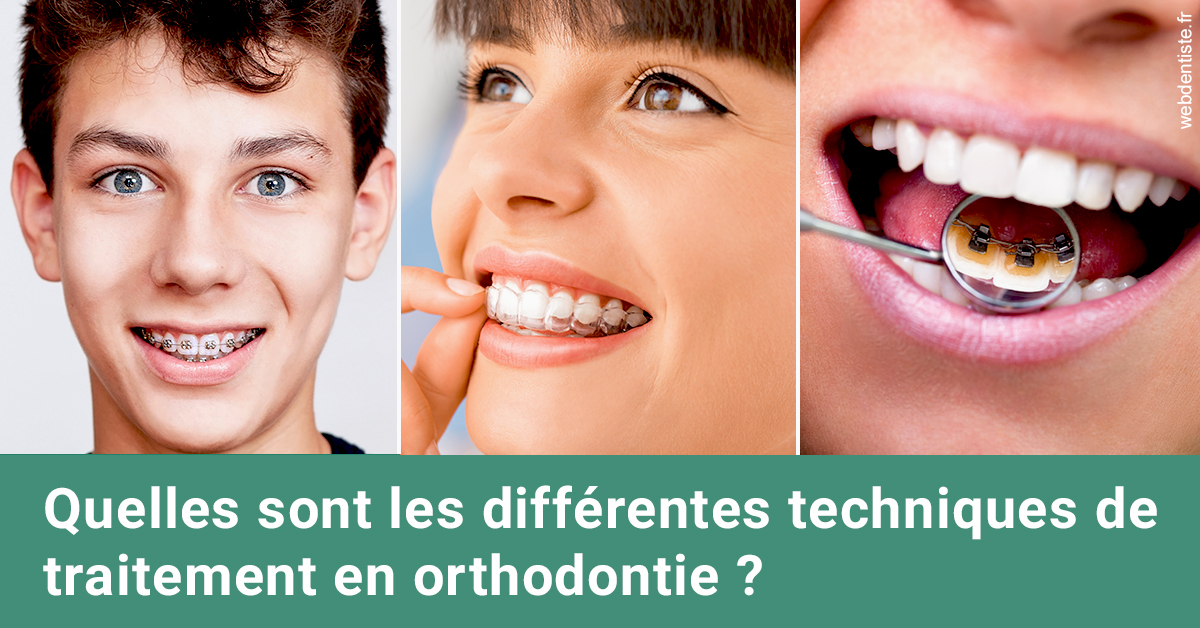 https://dr-roquette-guillaume.chirurgiens-dentistes.fr/Les différentes techniques de traitement 2