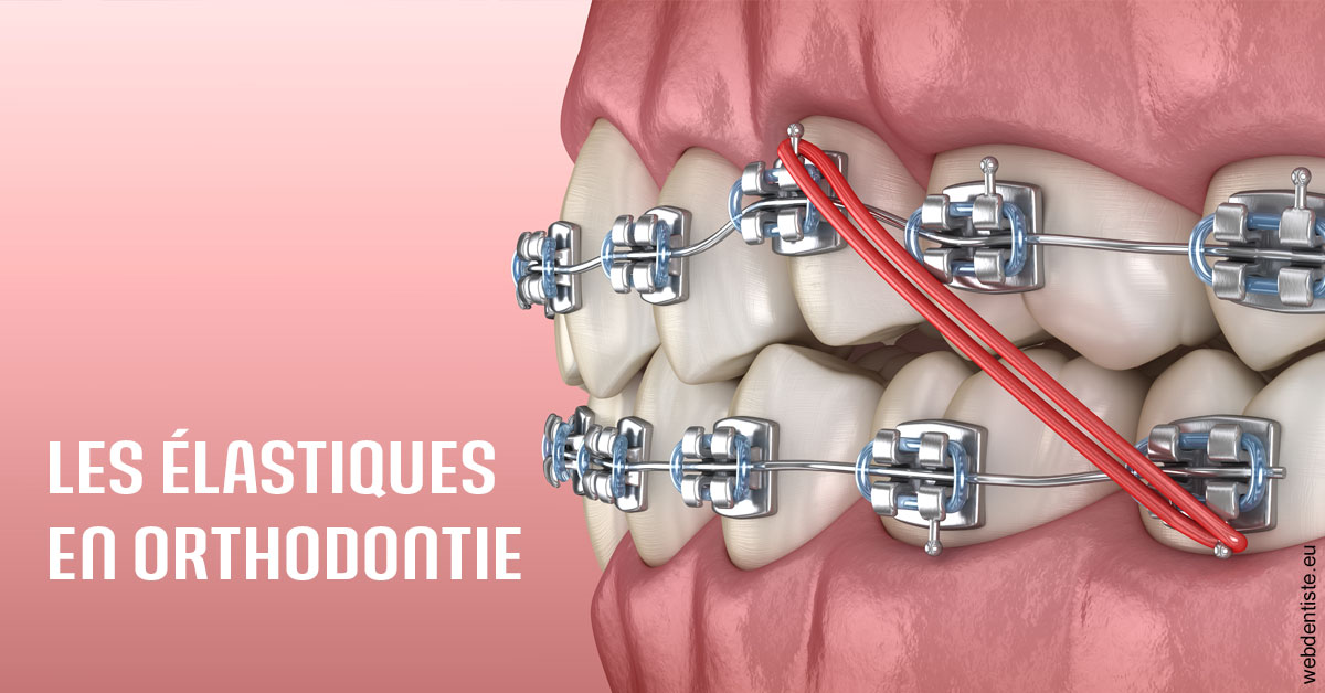 https://dr-roquette-guillaume.chirurgiens-dentistes.fr/Elastiques orthodontie 2