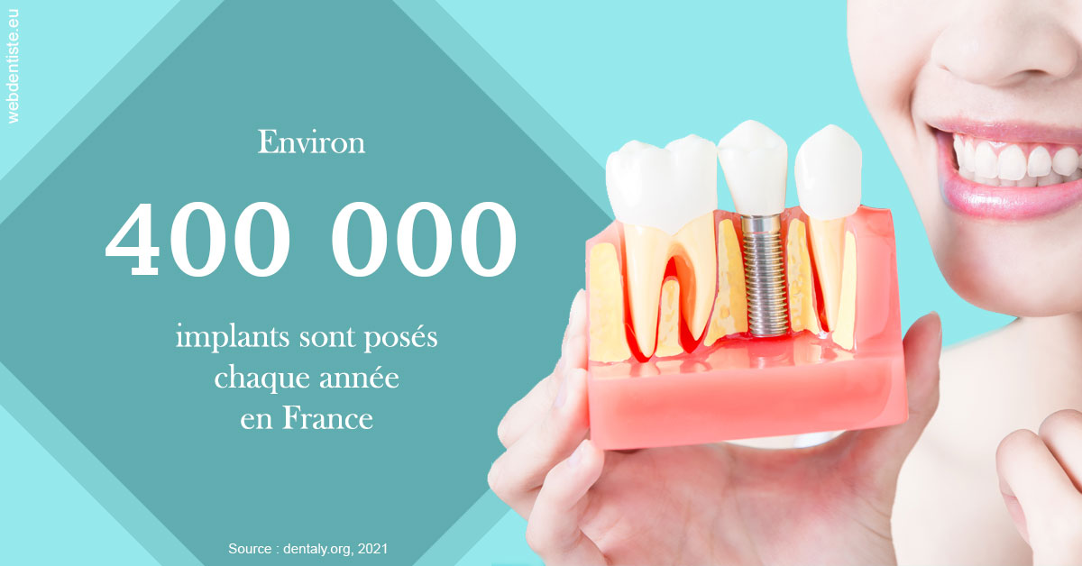 https://dr-roquette-guillaume.chirurgiens-dentistes.fr/Pose d'implants en France 2