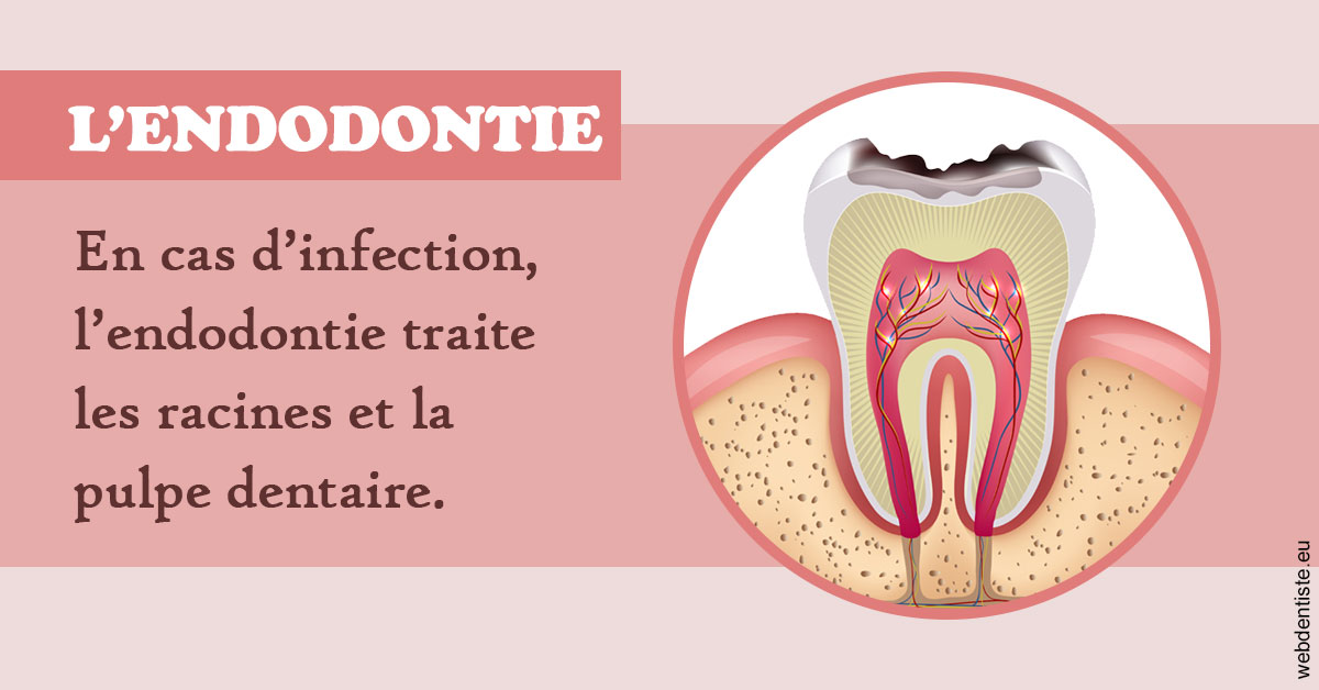 https://dr-roquette-guillaume.chirurgiens-dentistes.fr/L'endodontie 2